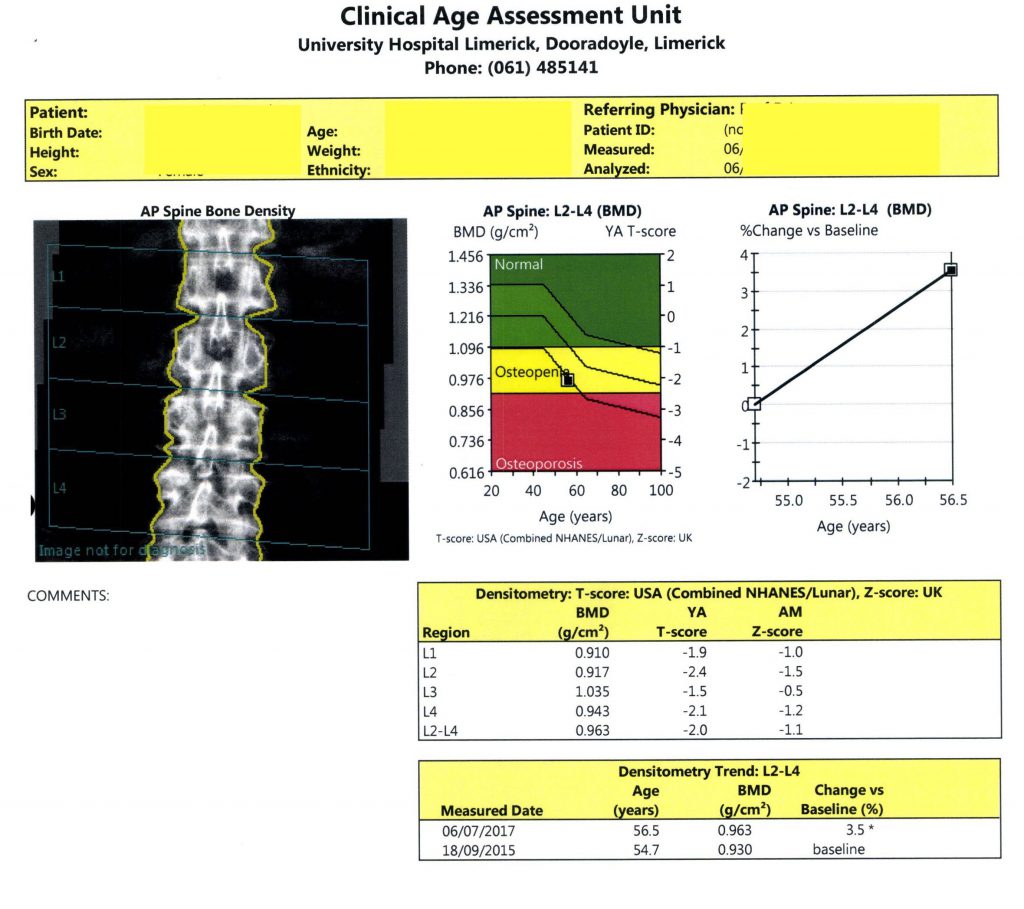 https://www.dexalimerick.ie/wp-content/uploads/2021/01/DEXA-Scan-Spine-sample-1-1024x909.jpg